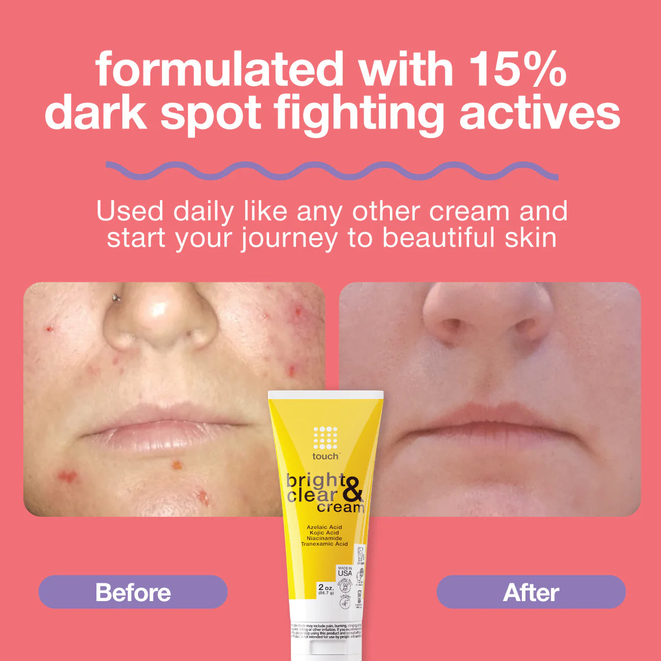 Touch Bright And Clear Cream 56.7g