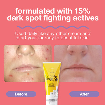 Touch Bright And Clear Cream 56.7g